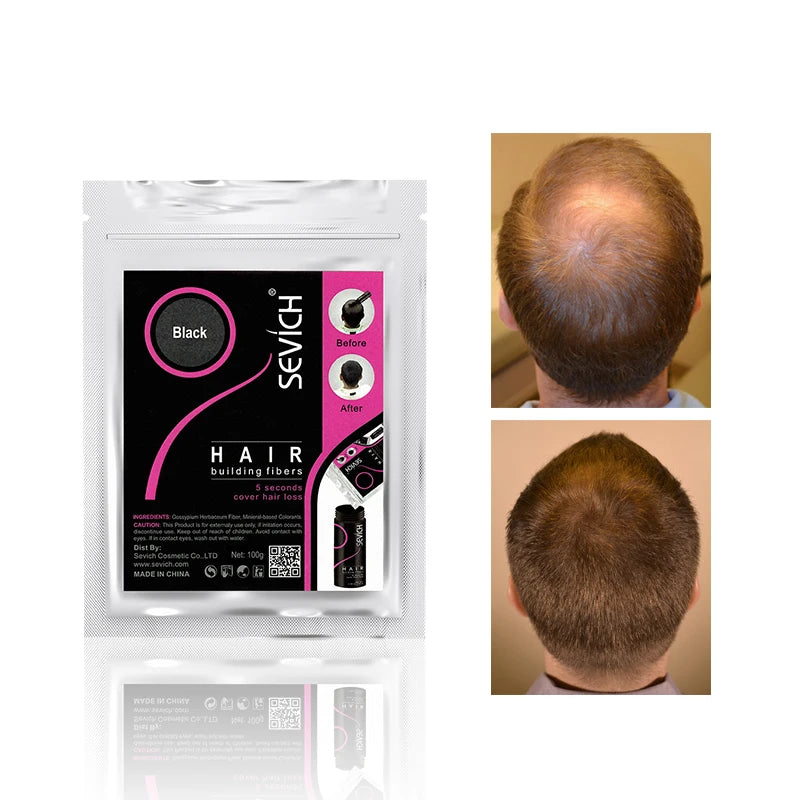 Sevich 100g 10 Color Keratin Hair Loss Building Fiber Hair Growth Fiber Refill Hair Loss Concealer