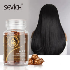 Sevich 30Pcs/bottle Ginger Anti-Hair Loss Capsules Hair Growth Dry Hair Scalp Care