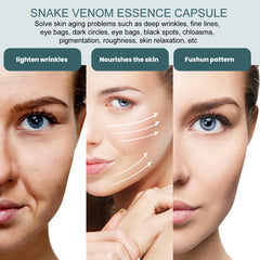 Snake Venom Facial Essence Capsule Fade Dark Spot Fine Lines Moisturizing Skin Repair Serum