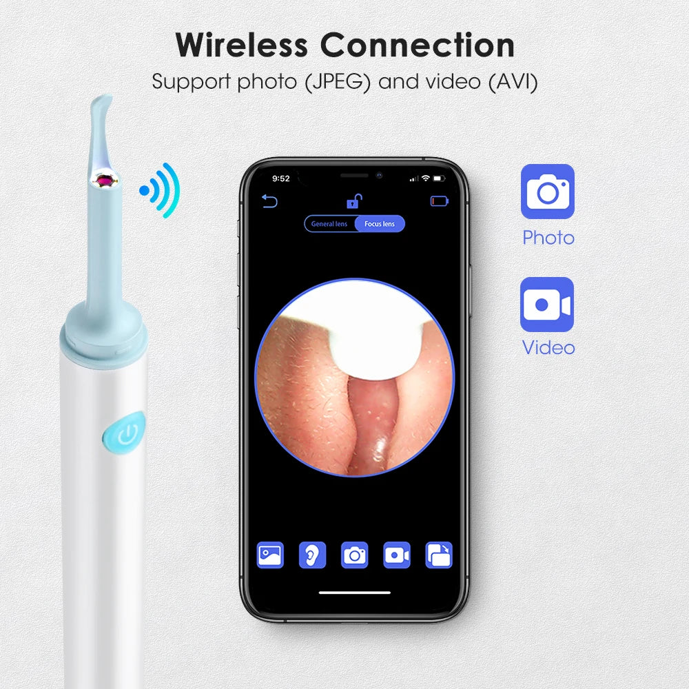 Otoscope Removal Ear Pick