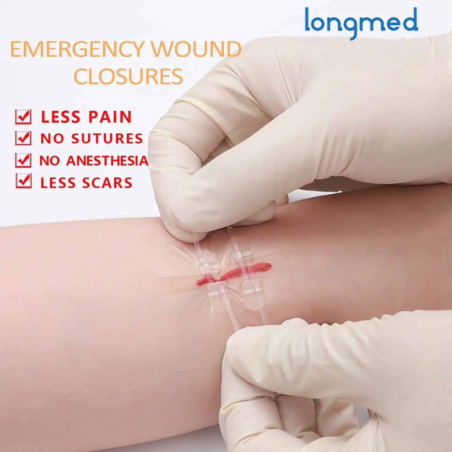 Painless Wound Closure Device