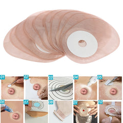 Stoma health Care tools