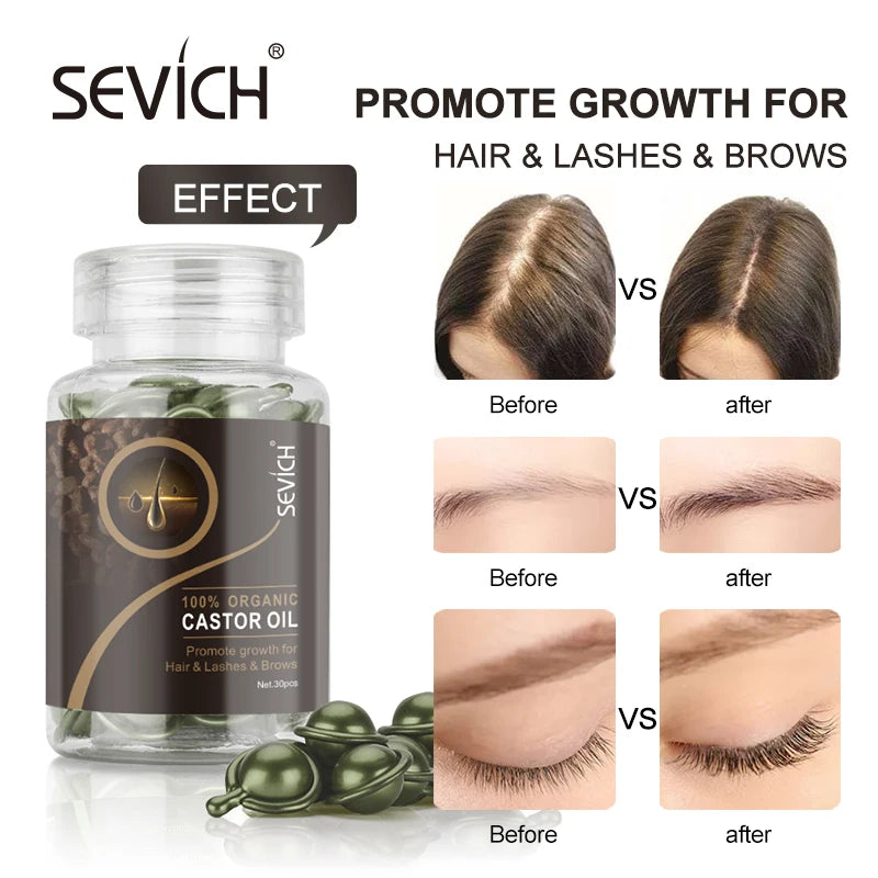 Sevich 30Pcs/bottle Ginger Anti-Hair Loss Capsules Hair Growth Dry Hair Scalp Care