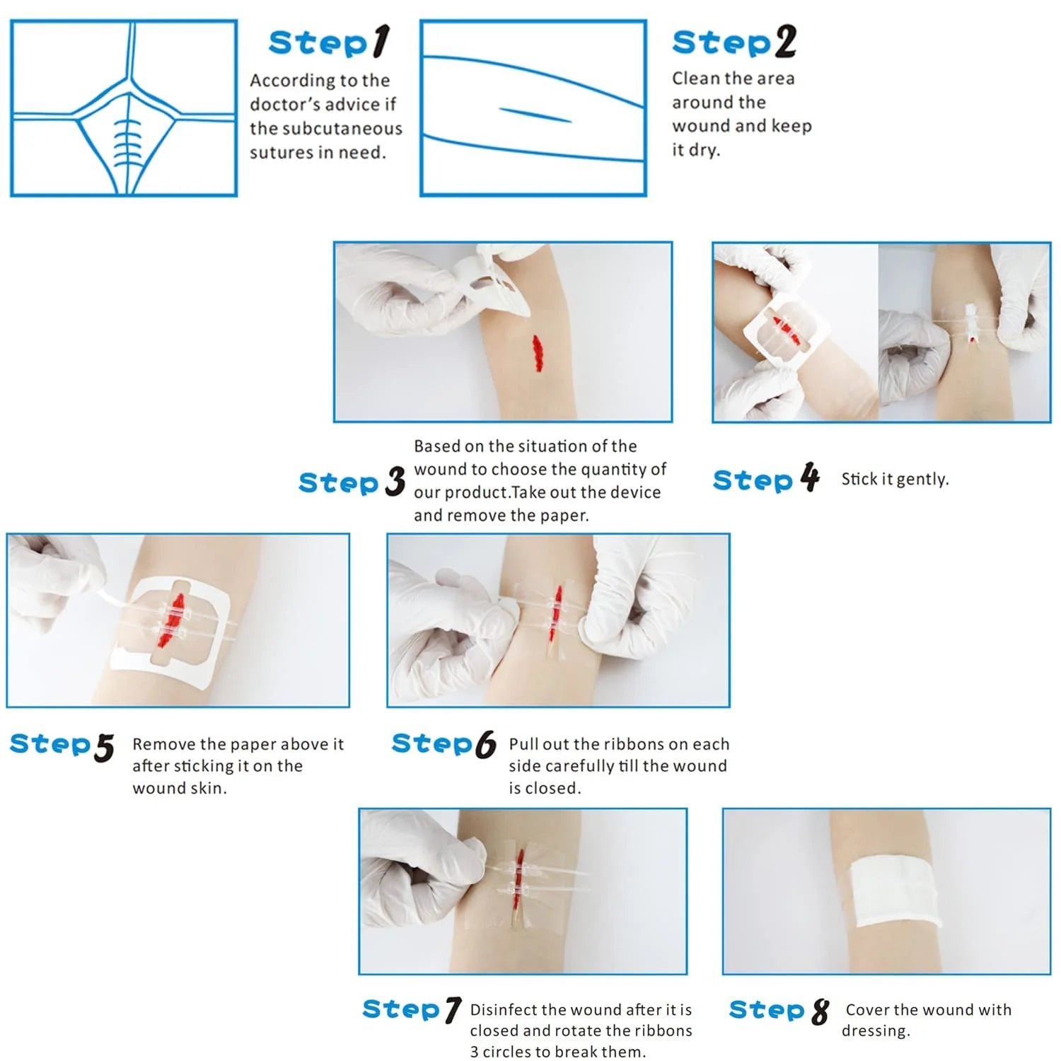 Painless Wound Closure Device