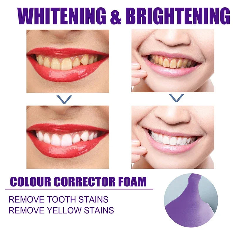 50ml V34 Mousse Toothpaste Teeth Whitening Removing Yellow Teeth Cleaning Tooth