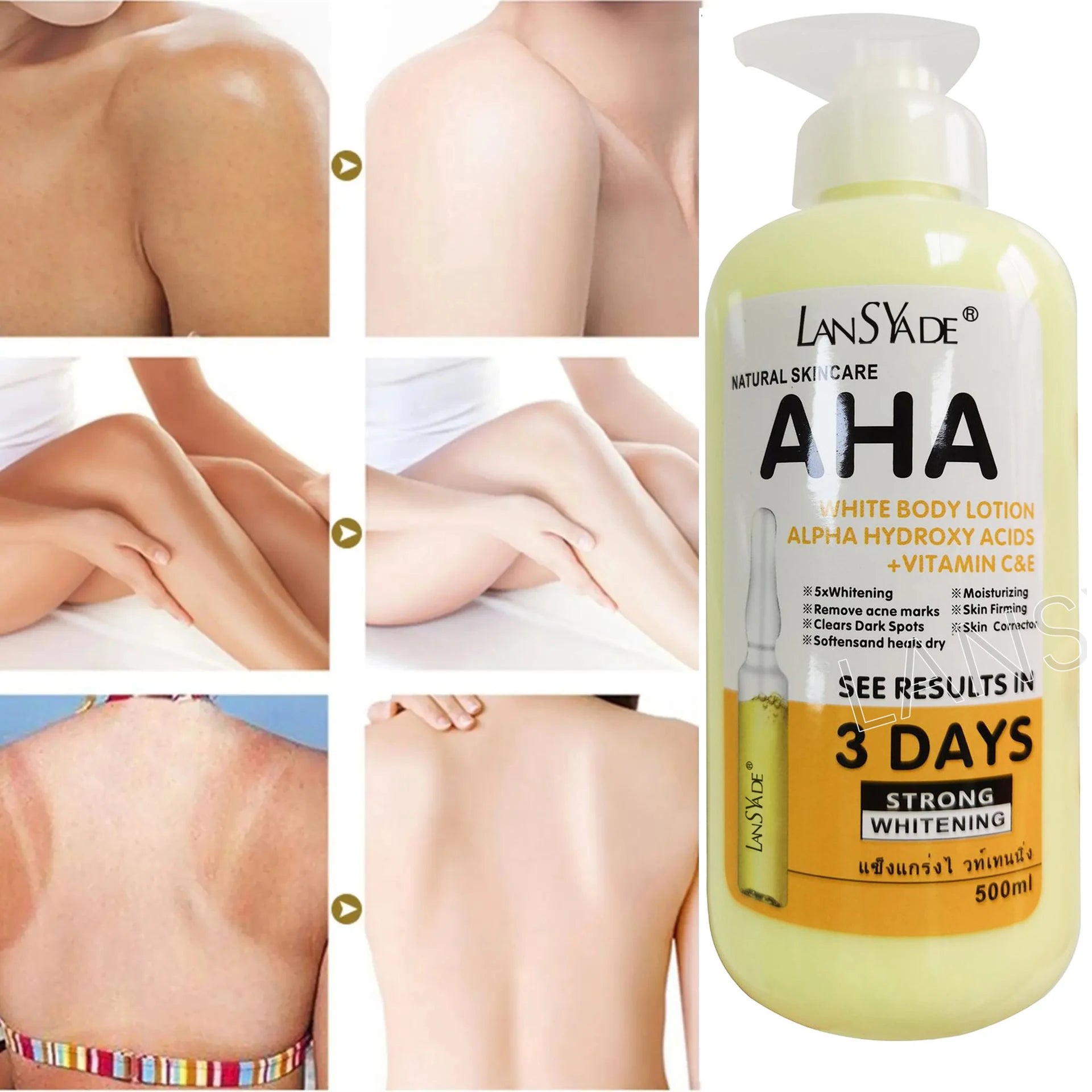 Whitening Body Lotion ALPHA Hydroxy Acids+Vitamin C&E See Results In 3 Days Moisturizing Lightening Body Cream Lotion Skin