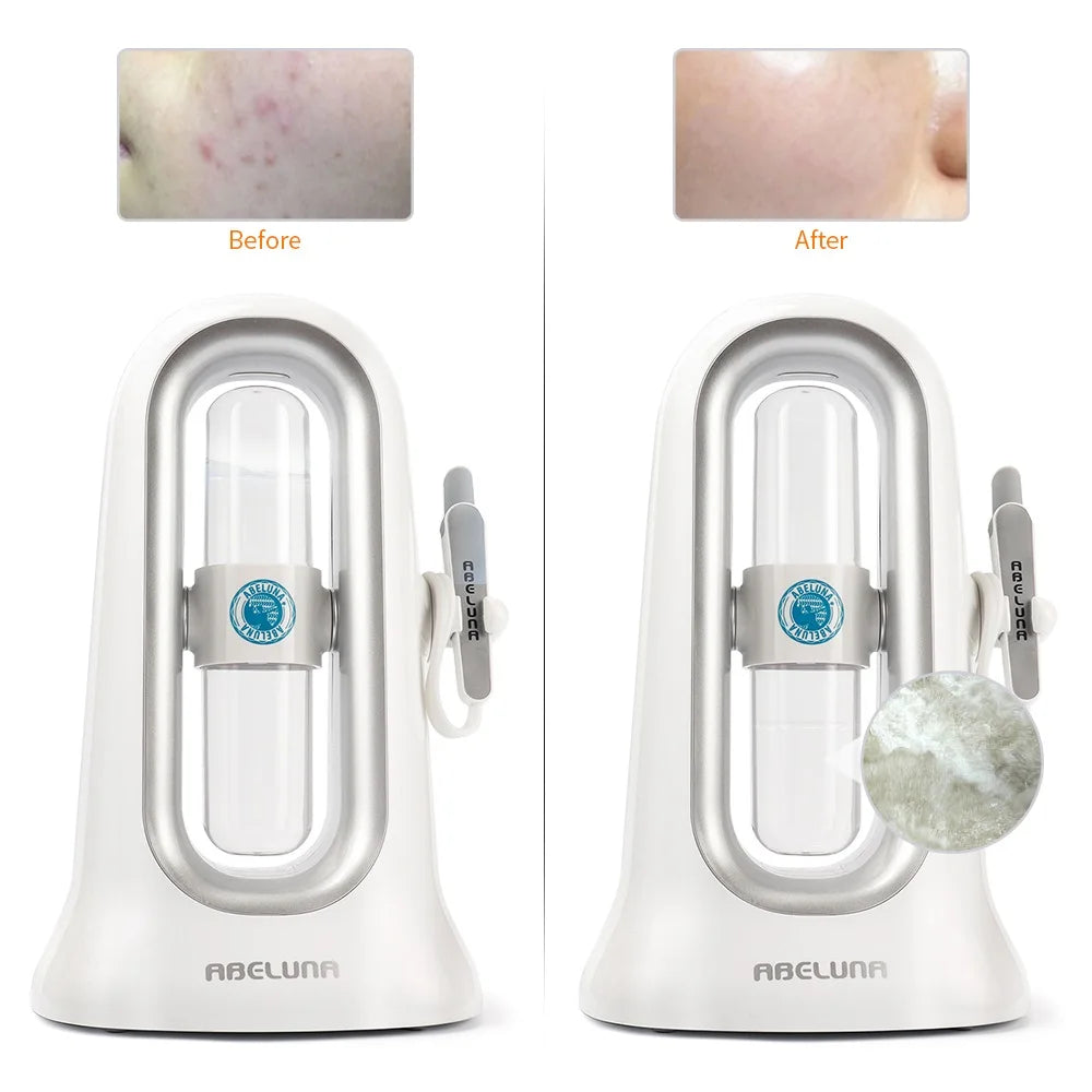 Hydra Dermabrasion Aqua Peeling Beauty Device