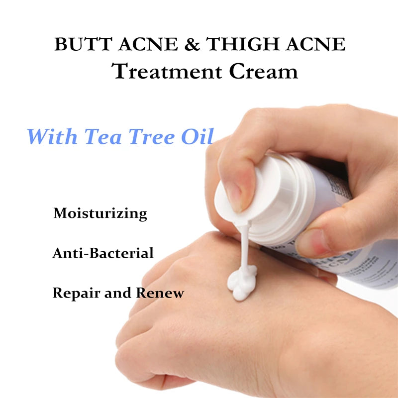 Butt Acne Cream Tea Tree Oil Remove Hip Thigh Acne Moisturizes Smooth Skin  Body Care Cream